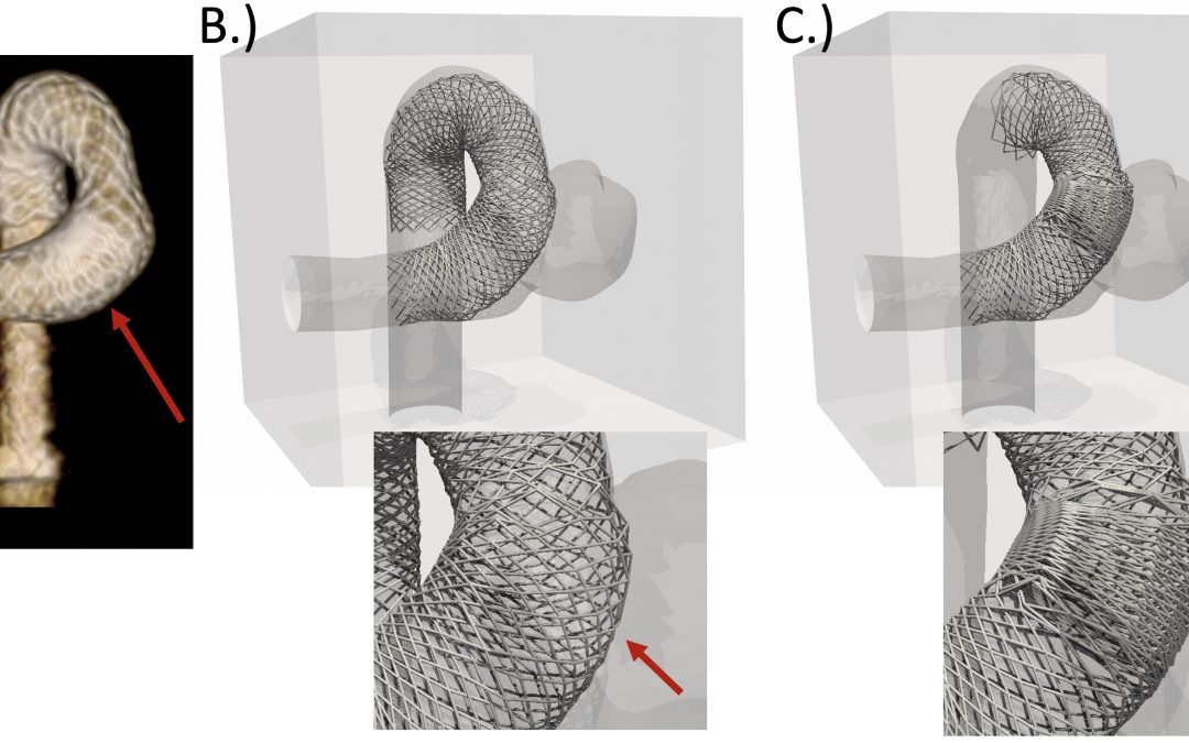 Virtual flow diverter implantation with realistic deployment mechanics and validated force response