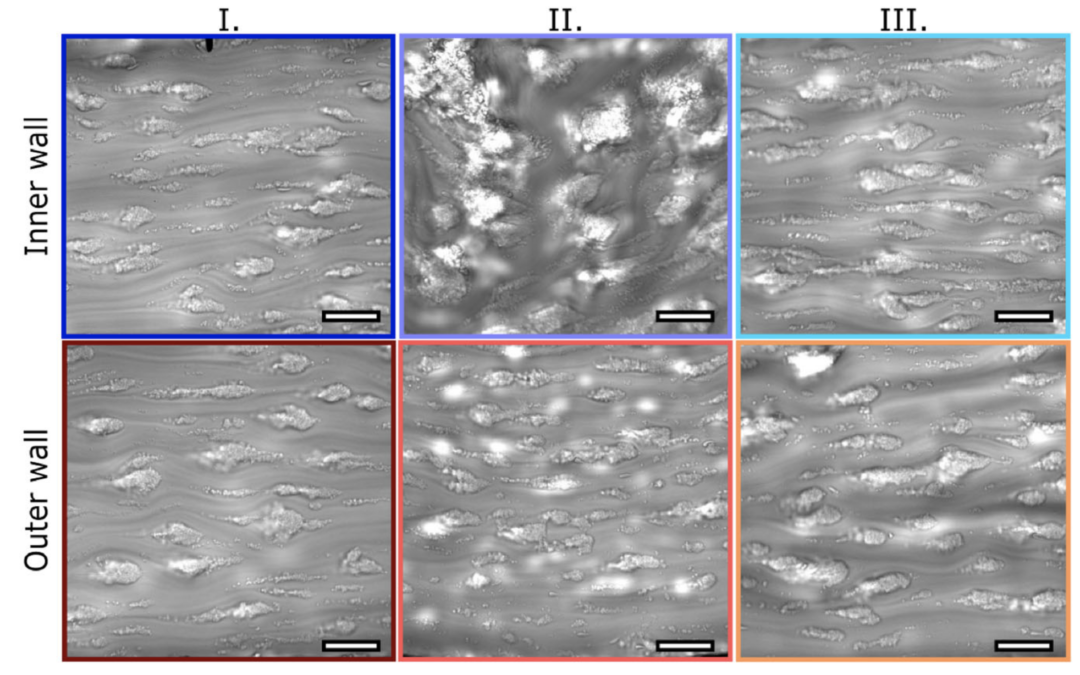The Effects of Micro-vessel Curvature Induced Elongational Flows on Platelet Adhesion